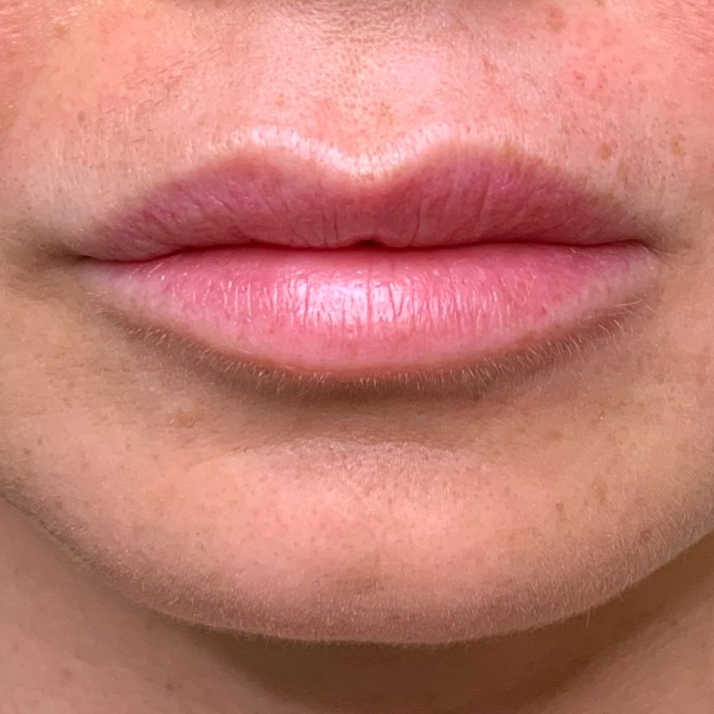 Lip Blushing BEFORE